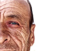 Protect Skin From Diabetes